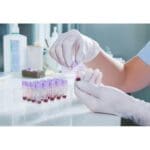 Koppelingen voeding, DIN11851, DIN11864, SMS, Macon